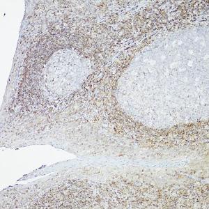 Immunohistochemistry analysis of paraffin-embedded human tonsil (100X) using Anti-Bcl-2 Antibody [ARC0173] (A306910) at a dilution of 1:100 (40X lens). Perform high pressure antigen retrieval with 10 mM citrate buffer pH 6.0 before commencing with IHC staining protocol