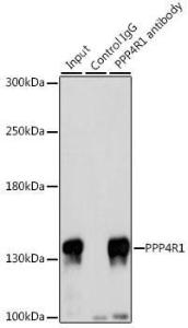 Immunoprecipitation analysis of 200 µg extracts of 293T cells using 3 µg of Anti-PPP4R1 Antibody (A12243). This Western blot was performed on the immunoprecipitate using Anti-PPP4R1 Antibody (A12243) at a dilution of 1:1000