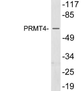 Antibody anti-PRMT4 100 µg