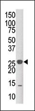 Anti-DUSP14 Rabbit Polyclonal Antibody