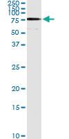 Anti-ACSL5 Antibody Pair