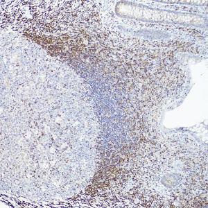 Immunohistochemistry analysis of paraffin-embedded human appendix tissue (100X) using Anti-Bcl-2 Antibody [ARC0173] (A306910) at a dilution of 1:100 (40X lens). Perform high pressure antigen retrieval with 10 mM citrate buffer pH 6.0 before commencing with IHC staining protocol