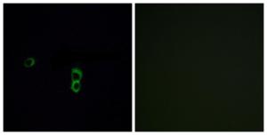 Immunofluorescence analysis of MCF7 cells using Anti-OR9Q1 Antibody. The right hand panel represents a negative control, where the antibody was pre-incubated with the immunising peptide