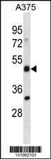 Anti-ADRM1 Rabbit Polyclonal Antibody (PE (Phycoerythrin))