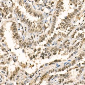 Anti-METTL3 Rabbit Polyclonal Antibody