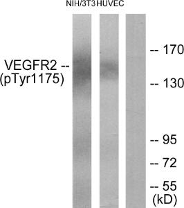 Anti-VEGFR 1+VEGFR 2 Rabbit Polyclonal Antibody