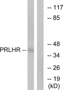 Western blot analysis of lysates from Jurkat cells using Anti-PRLHR Antibody The right hand lane represents a negative control, where the antibody is blocked by the immunising peptide