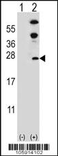 Anti-DUSP14 Rabbit Polyclonal Antibody