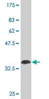 Anti-RBFOX2 Mouse Monoclonal Antibody [clone: 5E11]