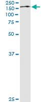 Anti-TRIM24 Antibody Pair