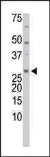 Anti-TXNL1 Rabbit Polyclonal Antibody (APC (Allophycocyanin))