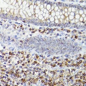 Immunohistochemistry analysis of paraffin-embedded human appendix tissue (400X) using Anti-Bcl-2 Antibody [ARC0173] (A306910) at a dilution of 1:100 (40X lens). Perform high pressure antigen retrieval with 10 mM citrate buffer pH 6.0 before commencing with IHC staining protocol