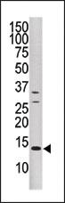 Anti-DUSP15 Rabbit Polyclonal Antibody