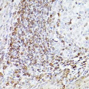 Immunohistochemistry analysis of paraffin-embedded human tonsil (400X) using Anti-Bcl-2 Antibody [ARC0173] (A306910) at a dilution of 1:100 (40X lens). Perform high pressure antigen retrieval with 10 mM citrate buffer pH 6.0 before commencing with IHC staining protocol