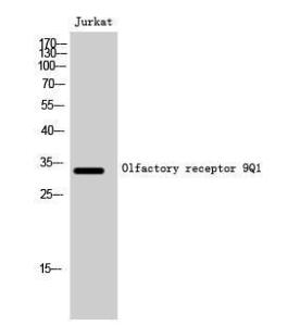 Western blot analysis of Jurkat cells using Anti-OR9Q1 Antibody