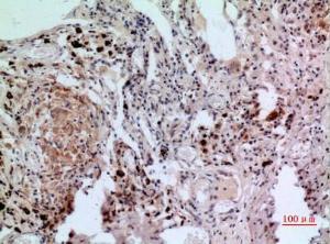 Immunohistochemical analysis of paraffin-embedded human lung using Anti-NFATC1 Antibody