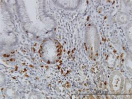 Anti-IKBKG Mouse Monoclonal Antibody [clone: 4G9]