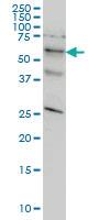 Anti-STK33 Mouse Monoclonal Antibody [clone: 6G1]