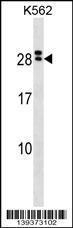 Anti-IL15RA Rabbit Polyclonal Antibody (APC (Allophycocyanin))