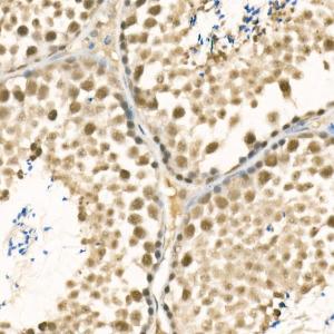 Anti-METTL3 Rabbit Polyclonal Antibody