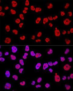 Anti-METTL3 Rabbit Polyclonal Antibody