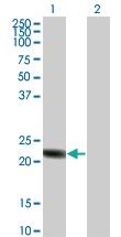 Anti-RGS5 Rabbit Polyclonal Antibody