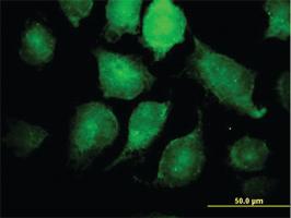 Anti-IKBKG Mouse Monoclonal Antibody [clone: 4G9]