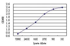 Anti-QARS Antibody Pair