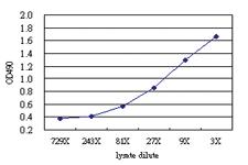 Anti-CD96 Antibody Pair