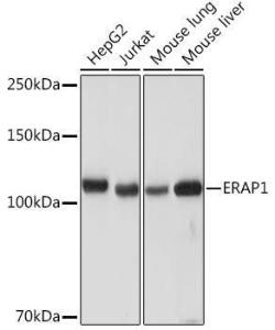 Western blot analysis of extracts of various cell lines, using Anti-ARTS1/ERAP1 Antibody [ARC2120] (A308078) at 1:1,000 dilution The secondary antibody was Goat Anti-Rabbit IgG H&L Antibody (HRP) at 1:10,000 dilution Lysates/proteins were present at 25 µg per lane