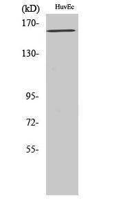 Anti-VEGFR 1+VEGFR 2 Rabbit Polyclonal Antibody