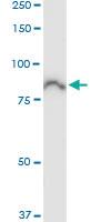 Anti-ACSL5 Polyclonal Antibody Pair