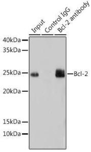 Immunoprecipitation analysis of 200 µg extracts of mouse lung using 3 µg of Anti-Bcl-2 Antibody [ARC0173] (A306910). This Western blot was performed on the immunoprecipitate using Anti-Bcl-2 Antibody [ARC0173] (A306910) at a dilution of 1:1000