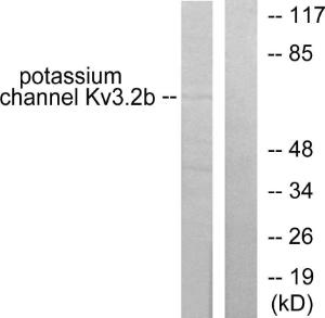 Western blot analysis of lysates from HepG2 cells using Anti-Potassium Channel Kv32b Antibody The right hand lane represents a negative control, where the antibody is blocked by the immunising peptide