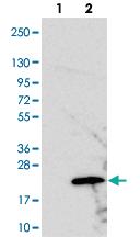 Anti-PRELID2 Rabbit Polyclonal Antibody