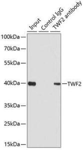 Immunoprecipitation analysis of 200µg extracts of 293T cells using 1µg of Anti-TWF2 Antibody (A306911). This Western blot was performed on the immunoprecipitate using Anti-TWF2 Antibody (A306911) at a dilution of 1:1000.