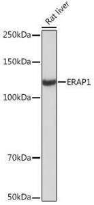 Western blot analysis of extracts of Rat liver, using Anti-ARTS1/ERAP1 Antibody [ARC2120] (A308078) at 1:1,000 dilution The secondary antibody was Goat Anti-Rabbit IgG H&L Antibody (HRP) at 1:10,000 dilution Lysates/proteins were present at 25 µg per lane