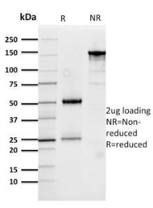 SDS-PAGE analysis of Anti-Cathepsin D Antibody [CTSD/3276] under non-reduced and reduced conditions; showing intact IgG and intact heavy and light chains, respectively. SDS-PAGE analysis confirms the integrity and purity of the antibody.