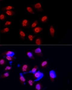 Anti-METTL3 Rabbit Polyclonal Antibody