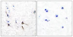 Immunohistochemical analysis of paraffin-embedded human brain tissue using Anti-Potassium Channel Kv32b Antibody The right hand panel represents a negative control, where the antibody was pre-incubated with the immunising peptide