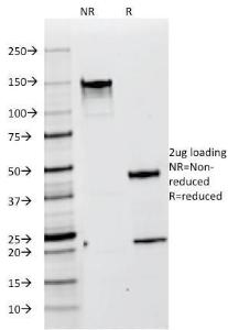 SDS-PAGE analysis of Anti-Melanoma gp100 Antibody [HMB45] under non-reduced and reduced conditions; showing intact IgG and intact heavy and light chains, respectively SDS-PAGE analysis confirms the integrity and purity of the antibody