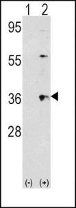 Anti-THPO Rabbit Polyclonal Antibody