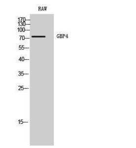 Western blot analysis of RAW cells using Anti-GBP4 Antibody