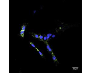 Trafficking of internalized NGFR/p75 receptor with clone 8J2, conjugated with ATTO 488 (green). Confocal images (40x magnification) demonstrate typical vesicle-like, punctuate perinuclear staining of internalized receptor/antibody.