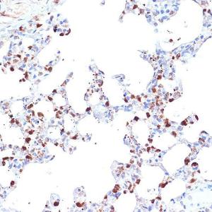 Immunohistochemistry analysis of paraffin-embedded rat lung using Anti-ARTS1/ERAP1 Antibody [ARC2120] (A308078) at a dilution of 1:100 (40x lens) Perform microwave antigen retrieval with 10 mM Tris/EDTA buffer pH 90 before commencing with IHC staining protocol