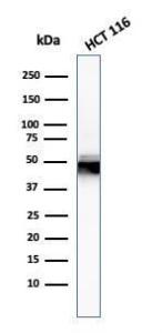 Western blot analysis of HCT116 cell lysate using Anti-Cytokeratin 8 Antibody [H1]