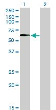 Anti-STK33 Mouse Monoclonal Antibody [clone: 6G1]