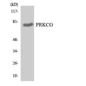 Western blot analysis of the lysates from HT 29 cells using Anti-PRKCG Antibody