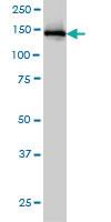 Anti-IKBKAP Mouse Monoclonal Antibody [clone: 6G9]