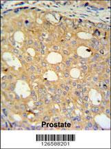 Anti-CMPK2 Rabbit Polyclonal Antibody (FITC (Fluorescein Isothiocyanate))